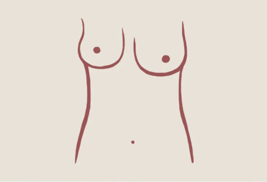 How Common Is Breast Asymmetry, Really?